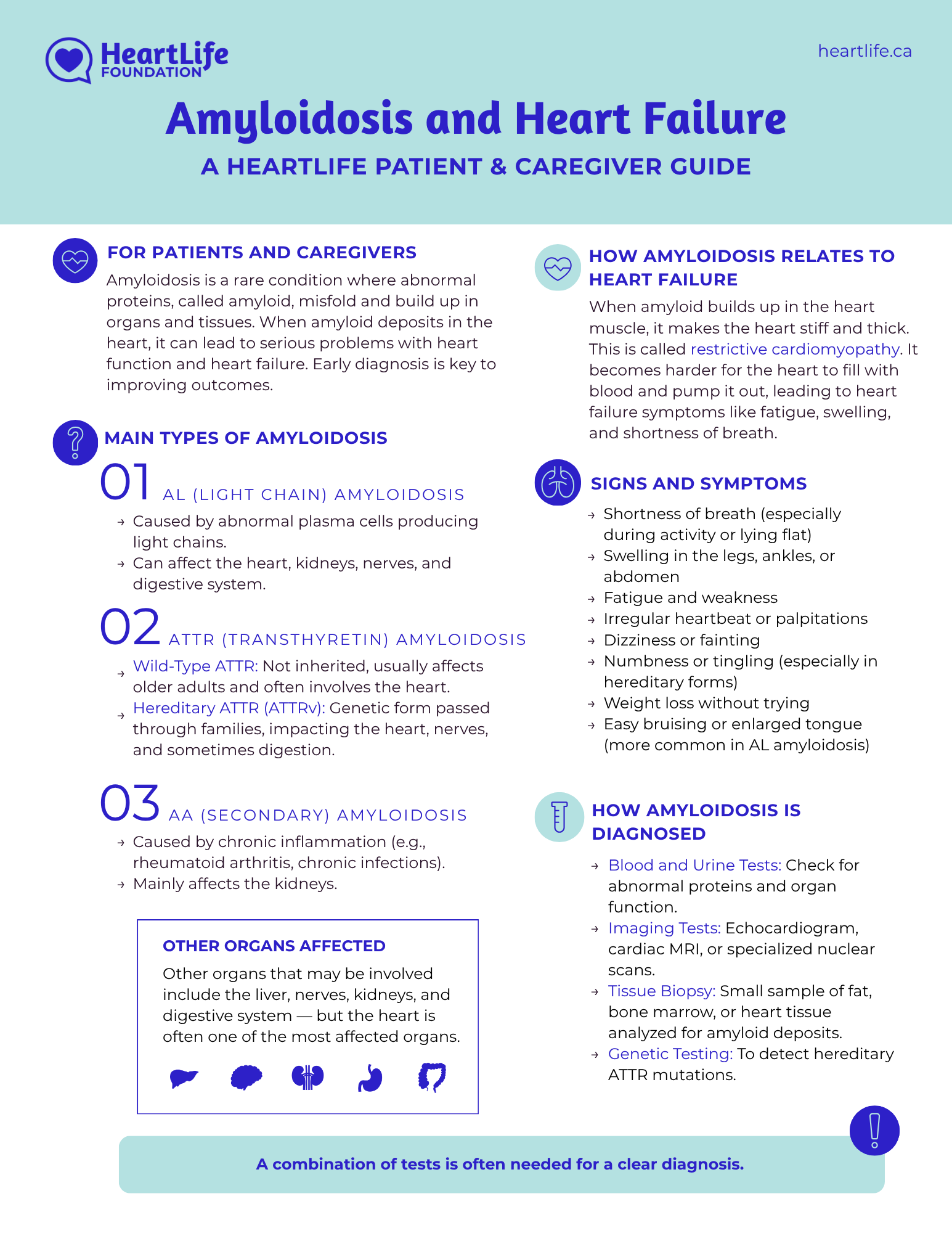 amyloidosis